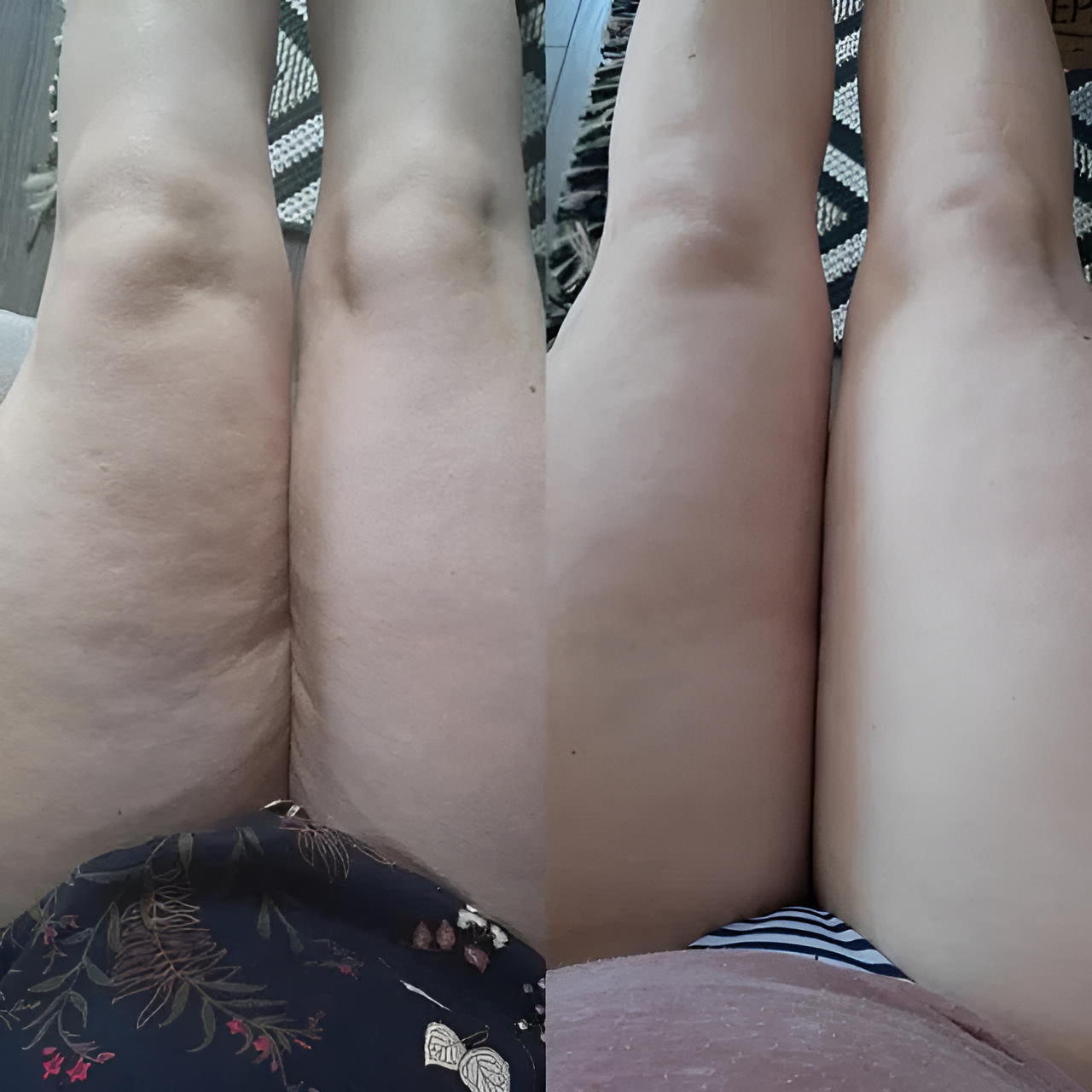 CircuFit - La Solution Naturelle Contre la Cellulite