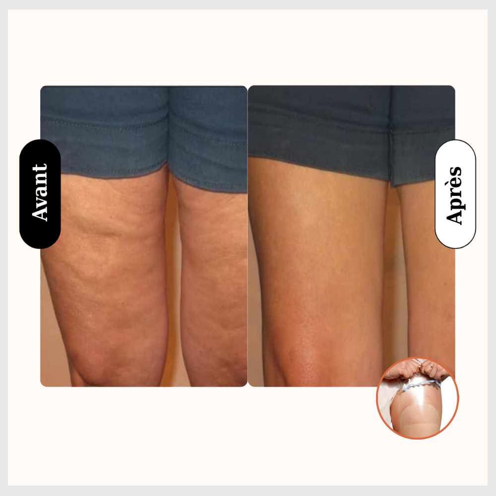 Patches Invisibles Effet Lift & Éclat Instantané