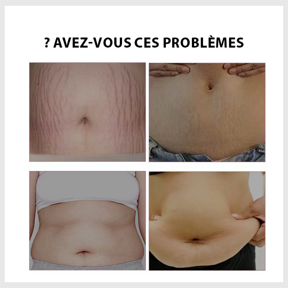 La crème raffermissante pour le ventre B FLAT