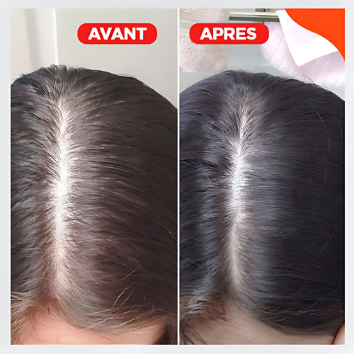 Capiluxe™ - Brosse de massage 3 en 1 pour stimuler les cheveux