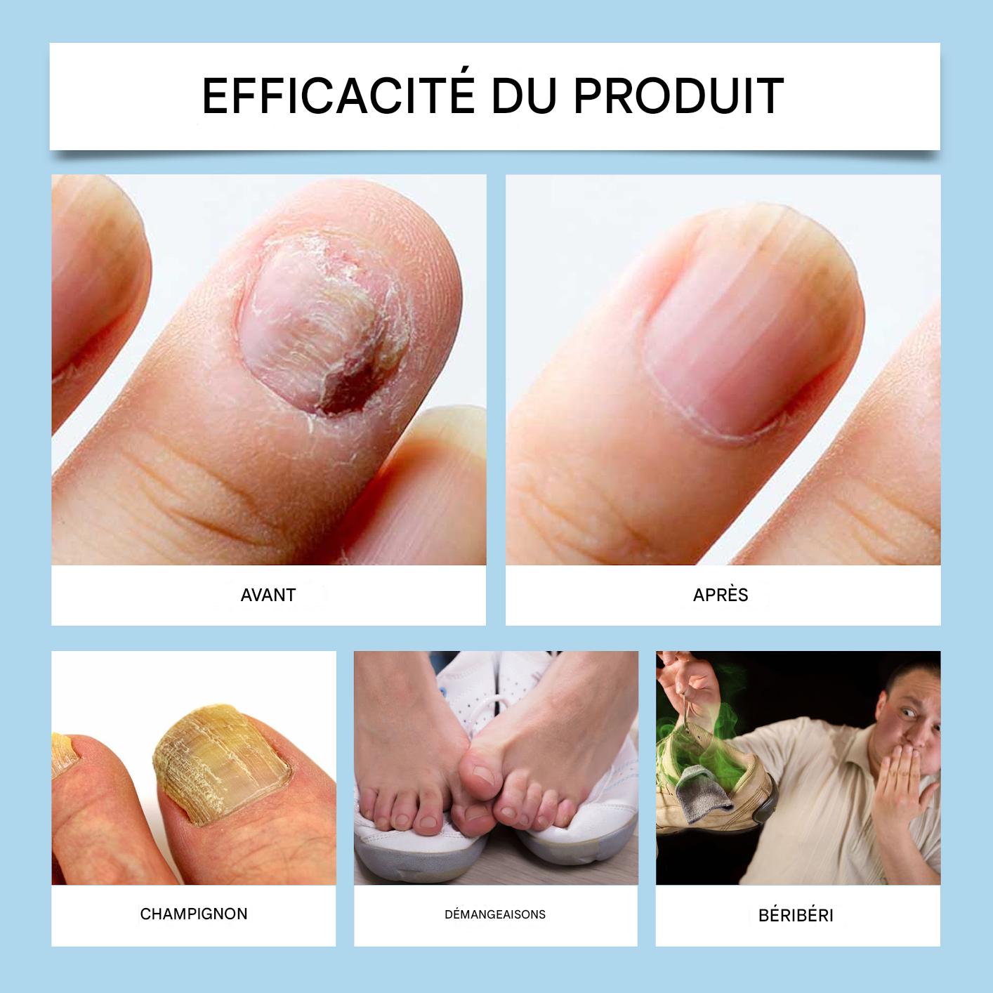 Nail Care Pro - Sérum Fortifiant et Réparateur pour les Ongles
