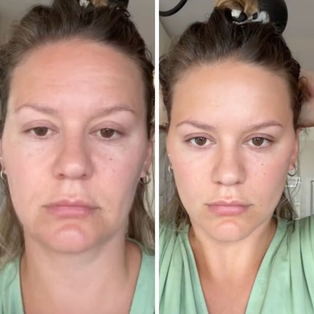 Ruban Liftant Invisible pour le Visage