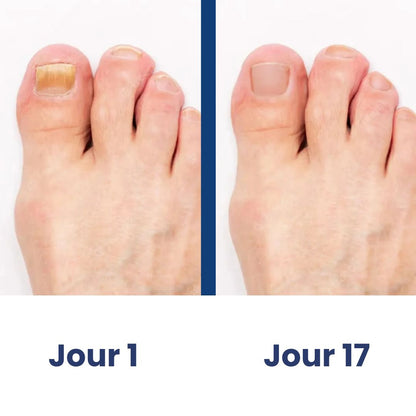 ClairOngle  – Soin Doux par Lumière Ciblée
