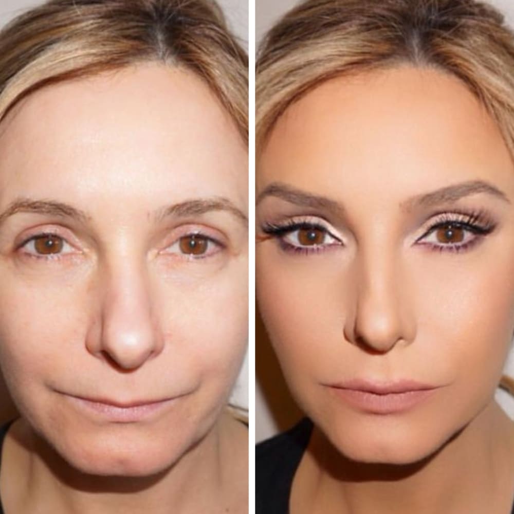 Ruban Liftant Invisible pour le Visage