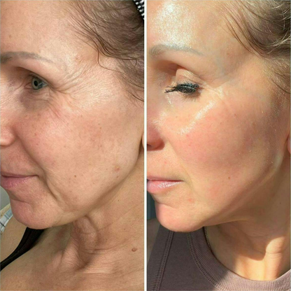 CollaKR™ – Rituel Anti-Âge Intensif au Triple Collagène