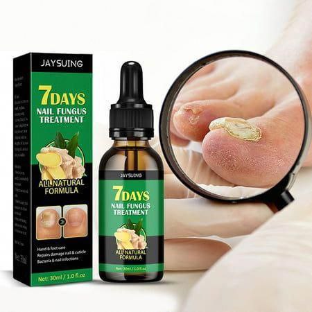 GingerGlow™ – Votre Solution Naturelle pour des Ongles Sains