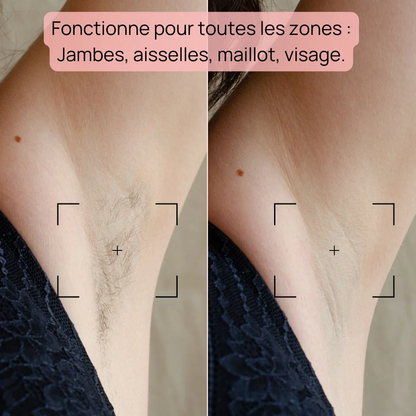 SilkPulse™ – L’Épilateur IPL Doux & Ultra-Efficace Pour Une Peau Lisse Sans Efforts