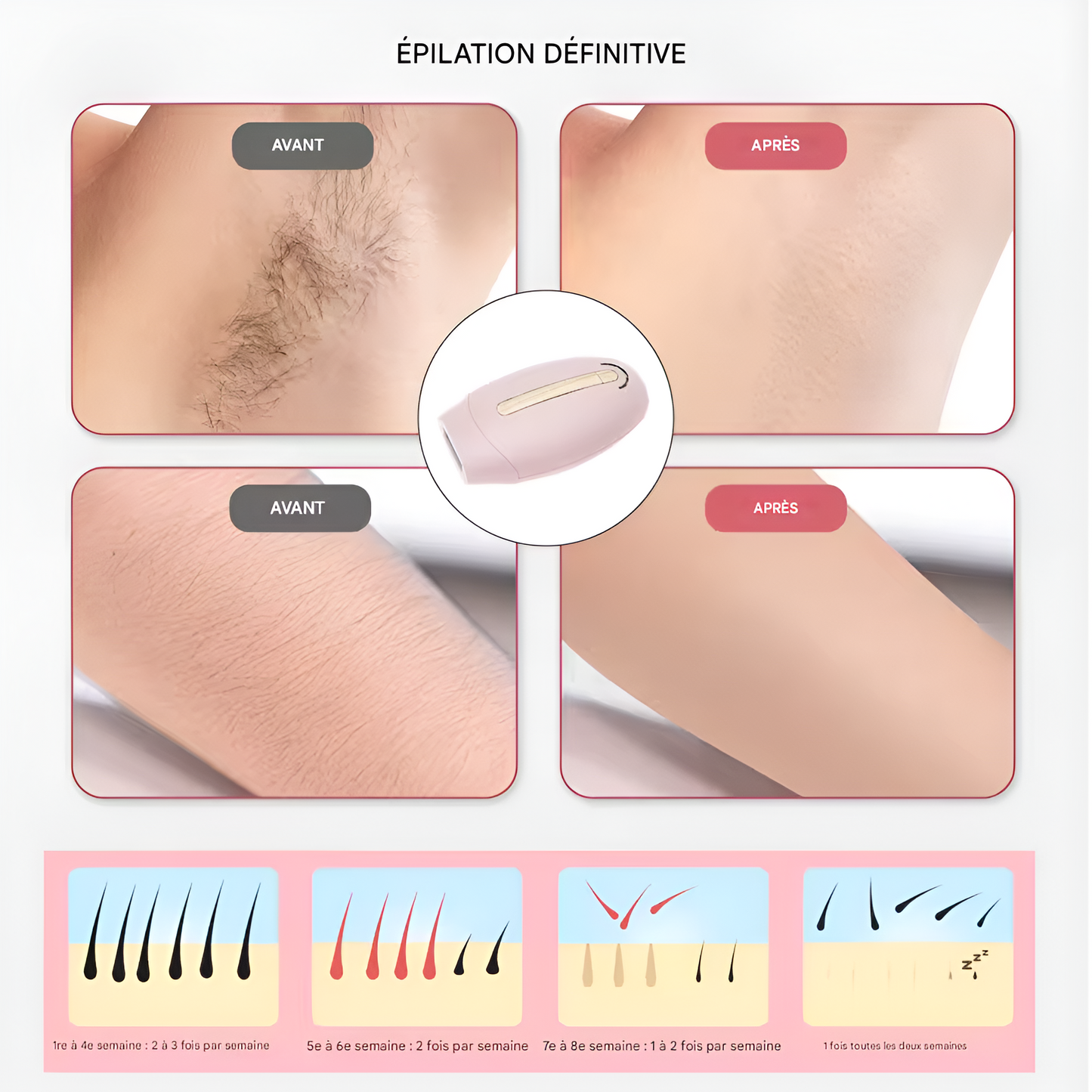 SilkPulse™ – L’Épilateur IPL Doux & Ultra-Efficace Pour Une Peau Lisse Sans Efforts