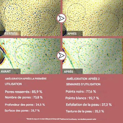 PeelShot™ – Duo Ampoules Réduisant les Pores