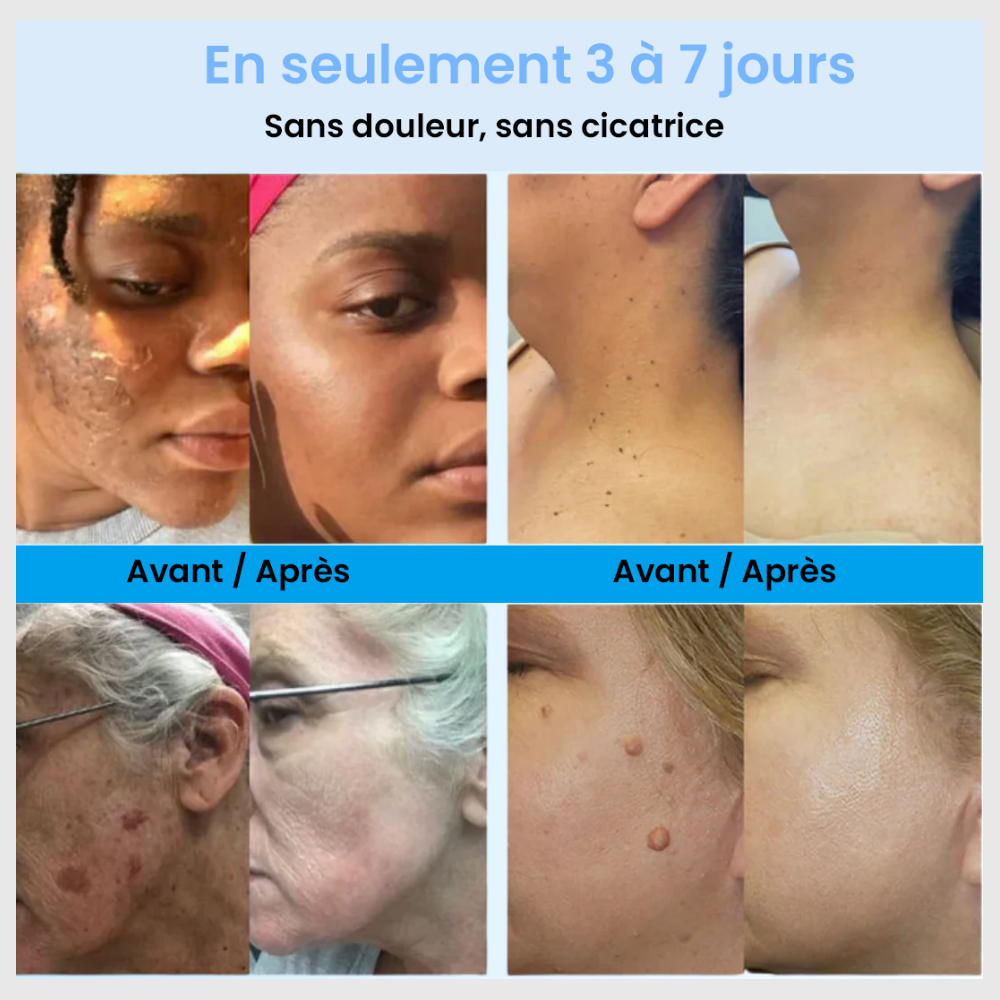 Citruséa™ – Exfoliant Éclat & Pureté