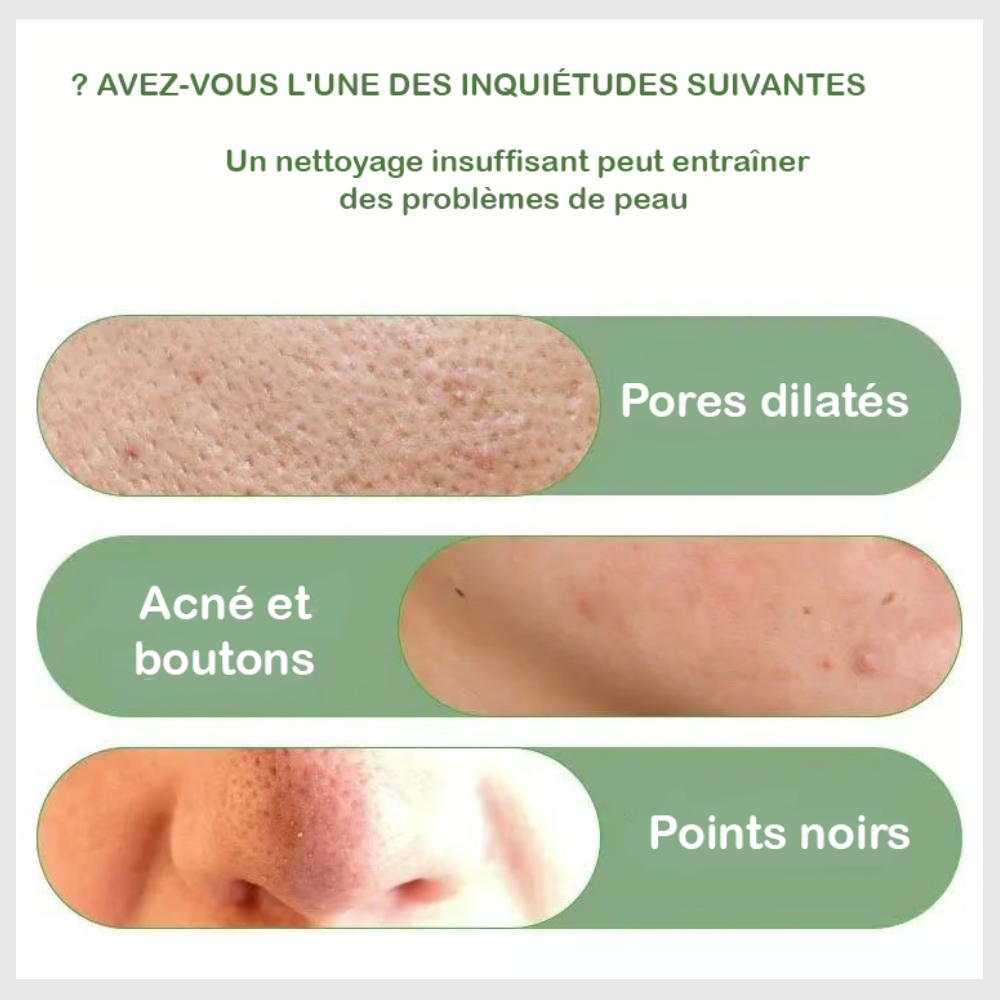 Pureté Verte™ - Adieu Acné et Points Noirs