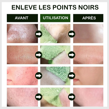 Pureté Verte™ - Adieu Acné et Points Noirs