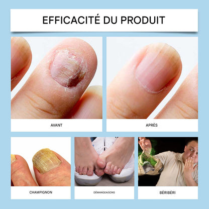 Nail Care Pro - Sérum Fortifiant et Réparateur pour les Ongles