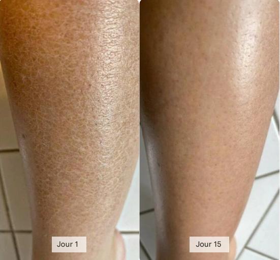 Serviette Exfoliante Longue Portée Antibactérienne