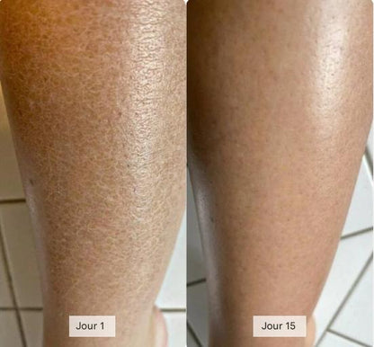 Serviette Exfoliante Longue Portée Antibactérienne