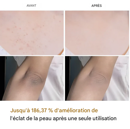 Dr. Melaxin™ Peel Shot – Spray Exfoliant Éclaircissant pour le Corps