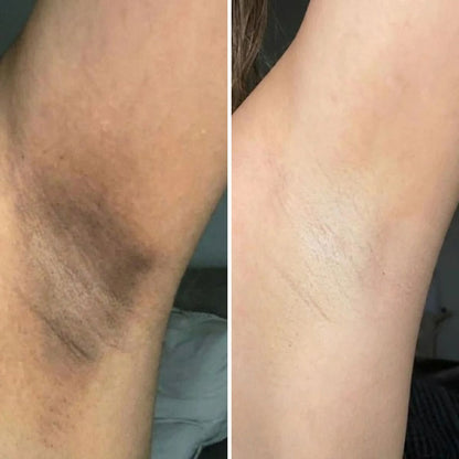 Dr. Melaxin™ Peel Shot – Spray Exfoliant Éclaircissant pour le Corps