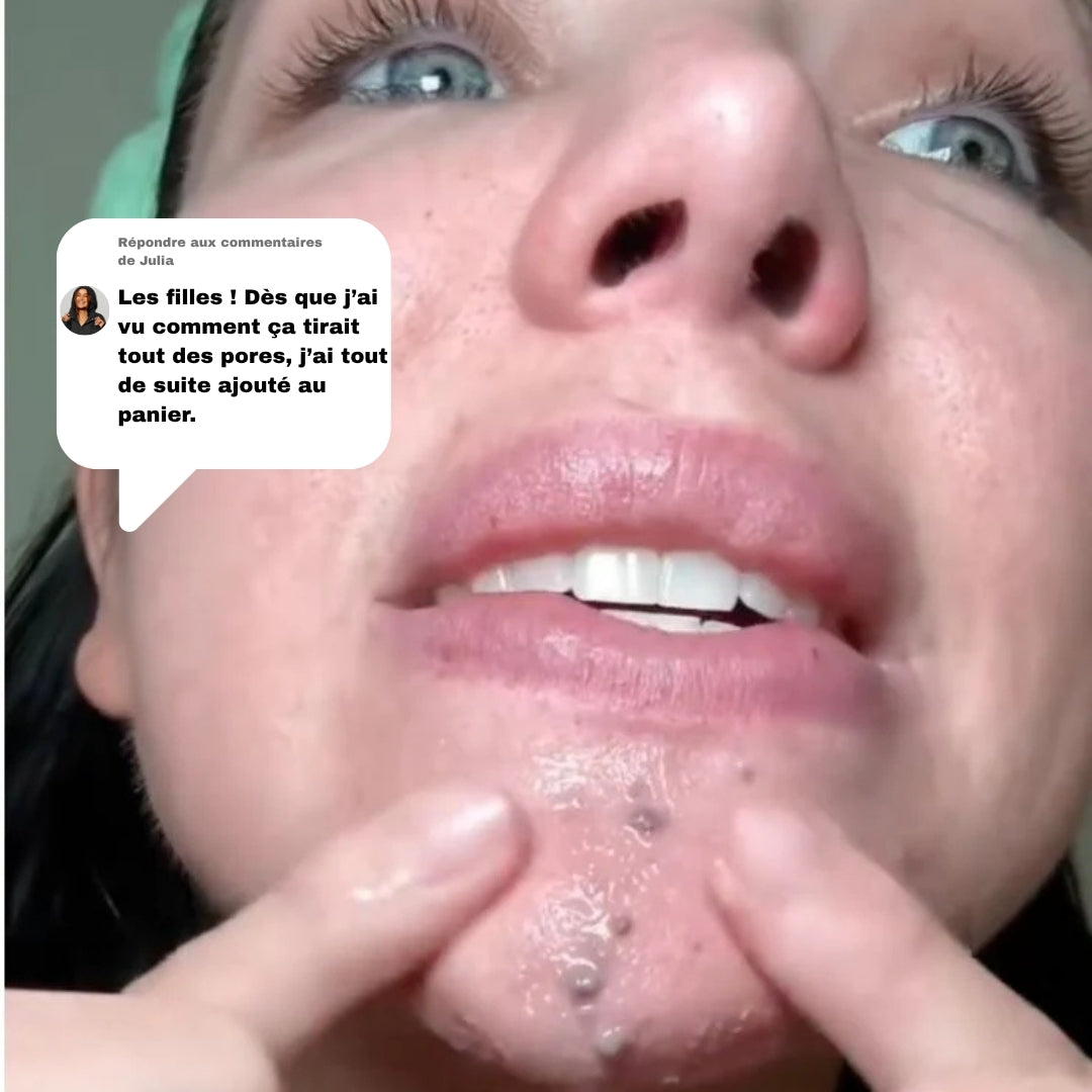 PeelShot™ – Duo Ampoules Réduisant les Pores