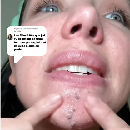 PeelShot™ – Duo Ampoules Réduisant les Pores