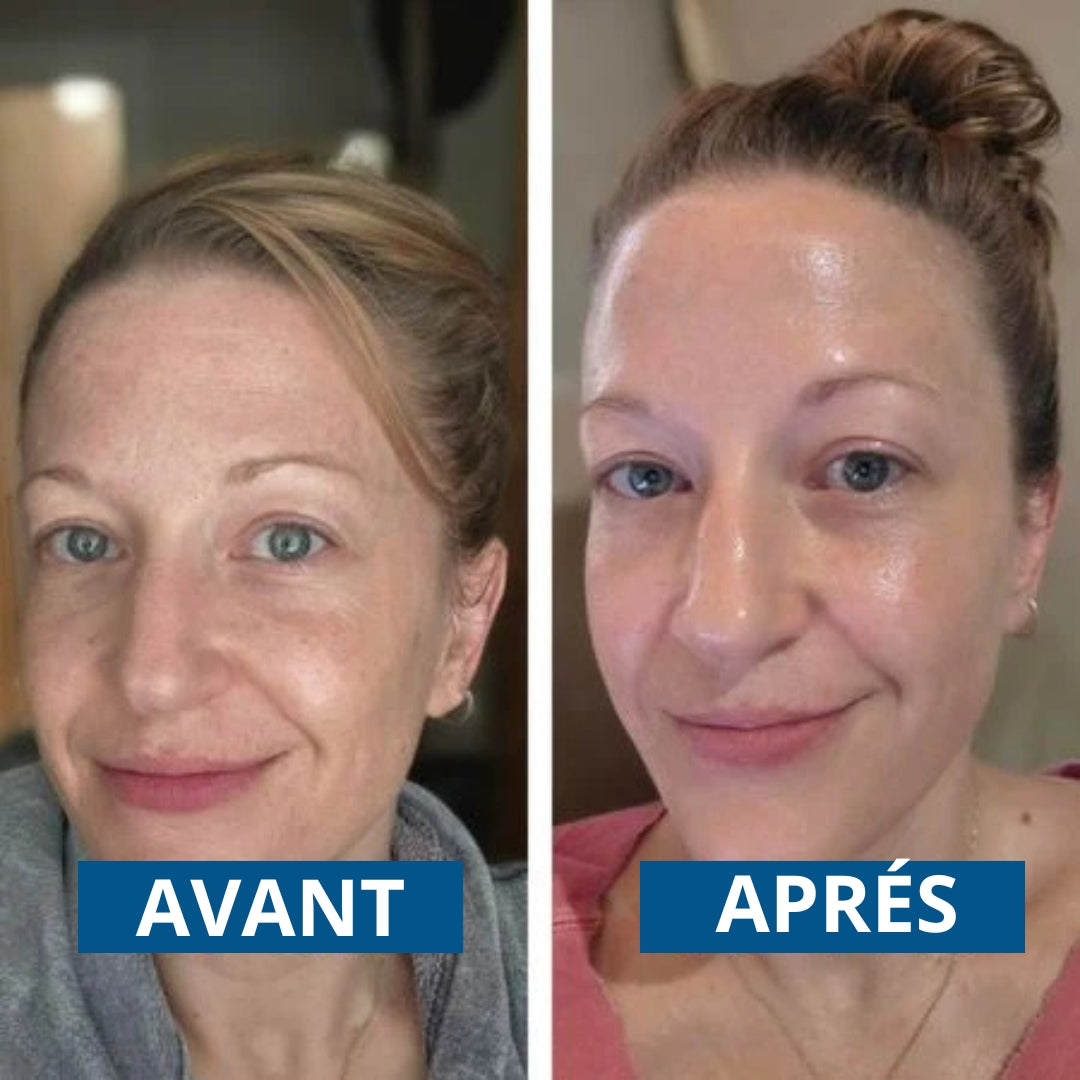 PeelShot™ – Duo Ampoules Réduisant les Pores