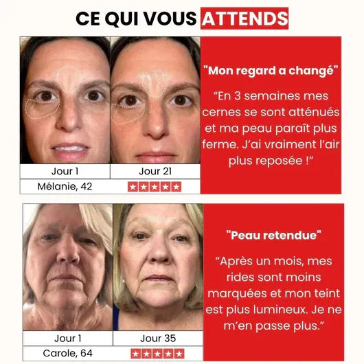 Lumi Beauty™- Appareil de lifting du visage et du cou