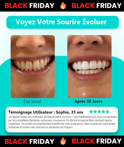 PureSonic™ – Brosse Sonique 30s