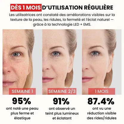 Lumi Beauty™- Appareil de lifting du visage et du cou