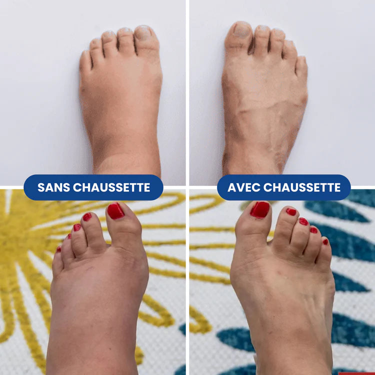 Medichausse™ – Bas de Compression Confort+